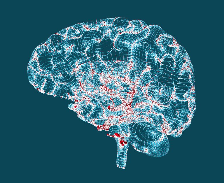 Brain degenerative diseases, Parkinson's, Alzheimer's, 3d rendering