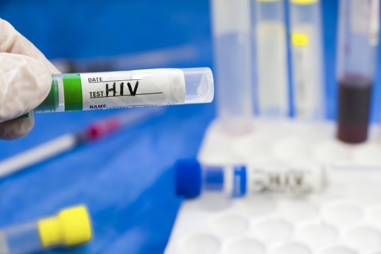 closeup-shot-of-an-empty-blood-test-sample-tube